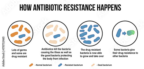 How antibiotic resistance happens diagram photo