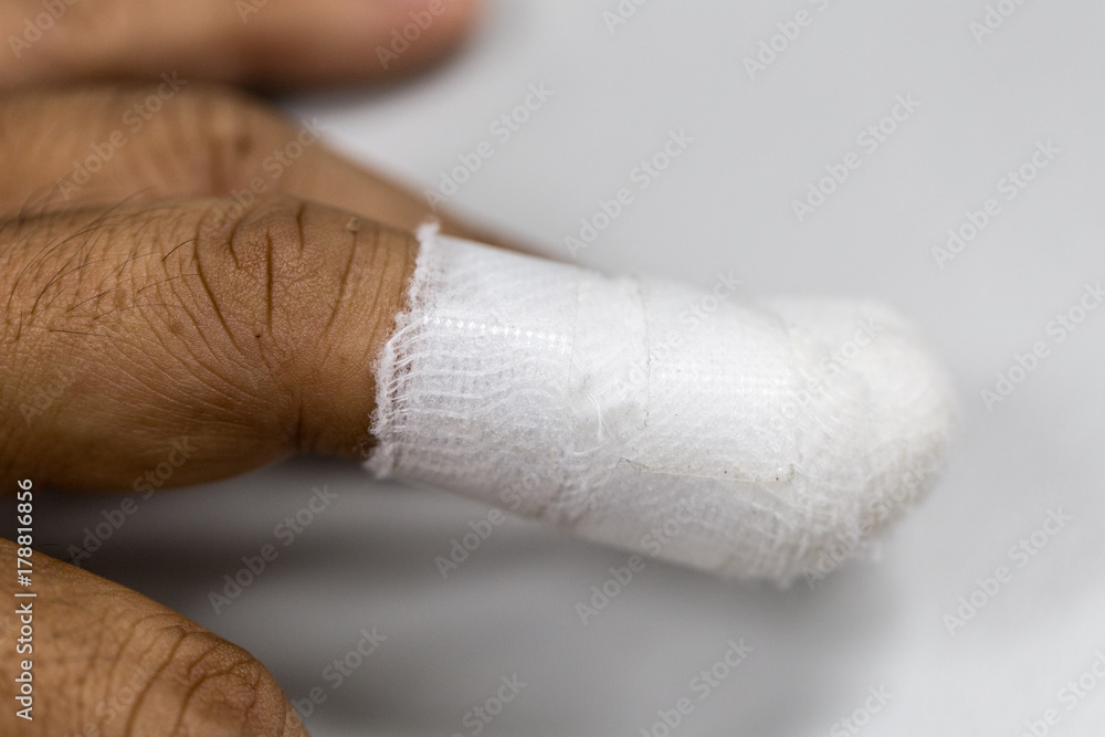 Injured painful finger with white gauze bandage, hand injury, Stock Photo |  Adobe Stock