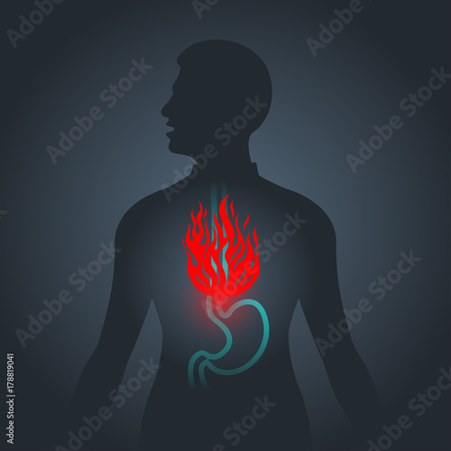 Dyspepsia vector logo icon illustration