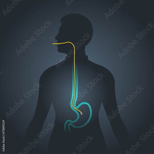 Gastroscopy vector logo icon illustration