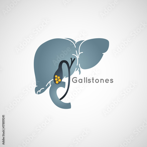 Gallstone vector logo icon illustration