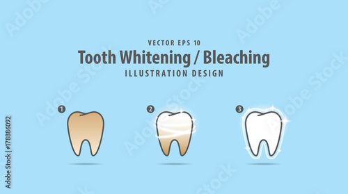 Step of single tooth Whitening-Bleaching illustration vector on blue background. Dental concept.