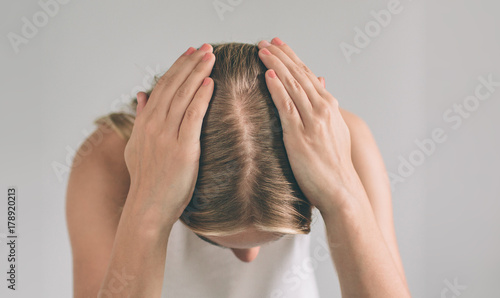 Tableau sur toile Women's hair is a top view close-up