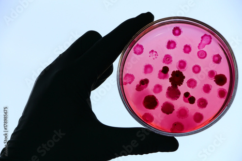 Scientist's hand in white lab coat and blue glove holding an opened Petri dish (plate) loaded with red agar Endo. Escherichia coli and other enterobacteria colonies.  Blue sly  background, backlight.