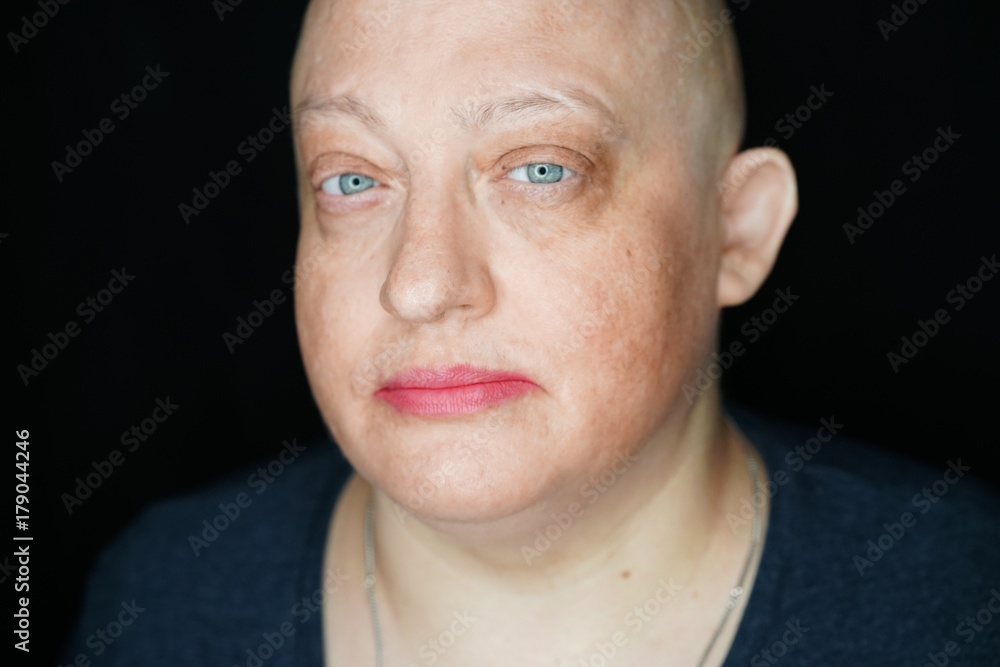 Fototapeta premium portrait of a bald woman