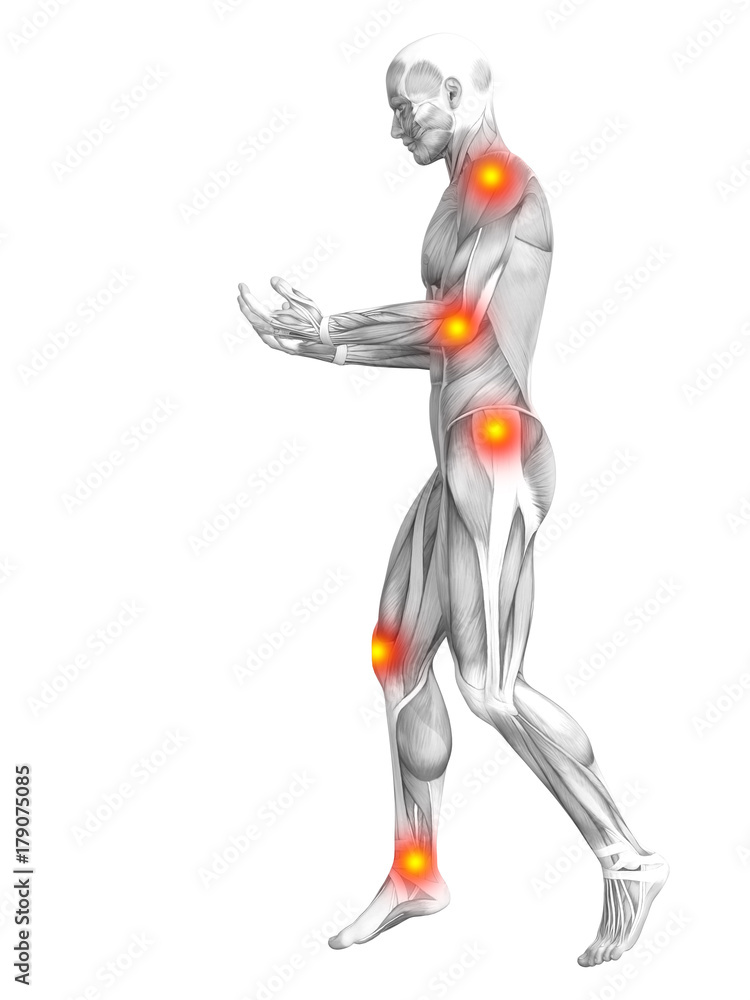Conceptual human muscle anatomy with red and yellow hot spot inflammation or articular joint pain for health care therapy or sport concepts. 3D illustration man arthritis or bone osteoporosis disease Conceptual human muscle anatomy with red and yellow hot spot inflammation or articular joint pain for health care therapy or sport concepts. 3D illustration man arthritis or bone osteoporosis disease