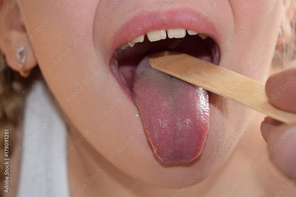 Naklejka premium throat examination, 