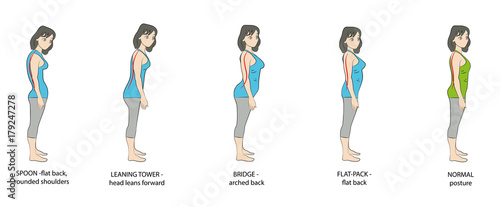 types of posture women. vector illustration.
