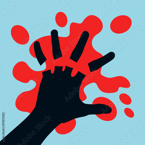Injury and accident leading to amputation of fingers on the hand - fingers are cutted off and chopped off. Blood stain around palm. Vector illustration