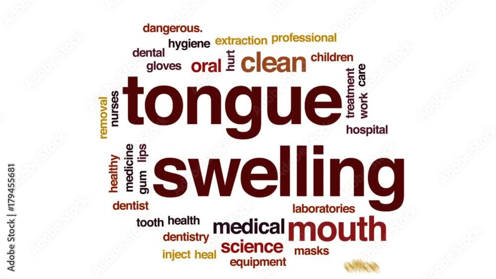 Tongue swelling animated word cloud, text design animation. Tongue swelling animated word cloud, text design animation.