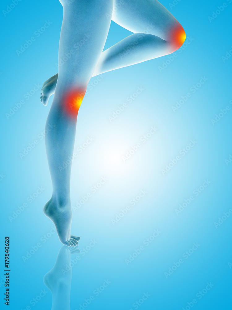 Conceptual beautiful woman or girl legs and feet with a hurt knee pain or ache closeup, 3D illustration of human slim fit body medical or health care concept, painful sport injury on blue background
