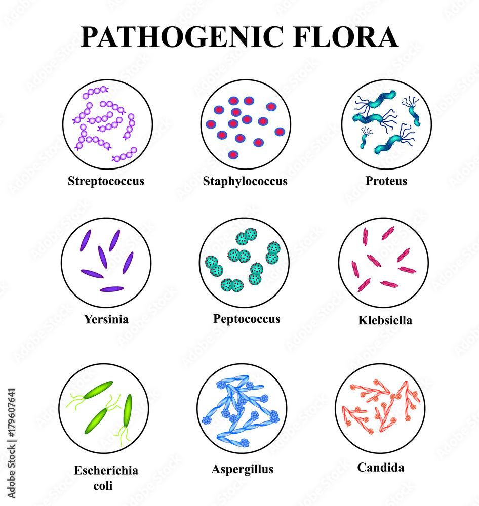 Pathogenic flora in the intestine. colon. infographics. Vector illustration on isolated background.