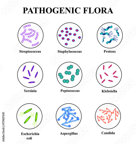 Pathogenic flora in the intestine. colon. infographics. Vector illustration on isolated background. photo