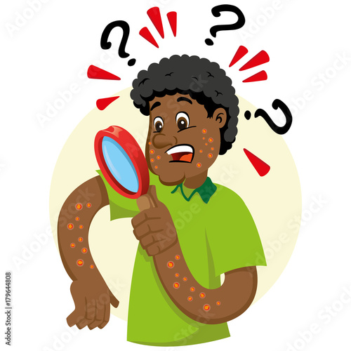 Mascot ben person, afro-descendant man, with allergy, rashes and dermatitis, symptom. Ideal for informational and institutional related to medicine