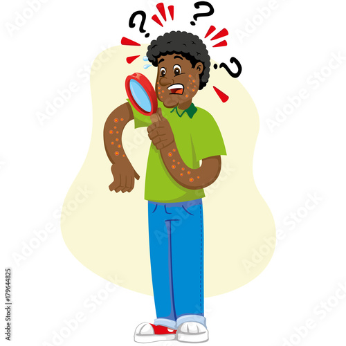 Mascot ben person, afro-descendant man, with allergy, rashes and dermatitis, symptom. Ideal for informational and institutional related to medicine