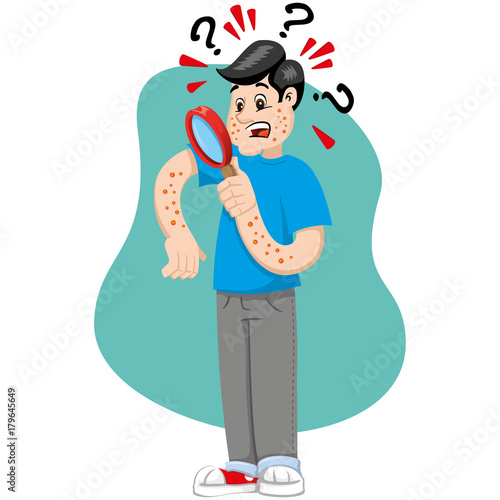 Mascot bob man person, with allergy, rashes and dermatitis, symptom. Ideal for informational and institutional related to medicine