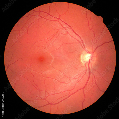left eye's retinal image with macula, vessels and optic disc isolated view on a black bacground