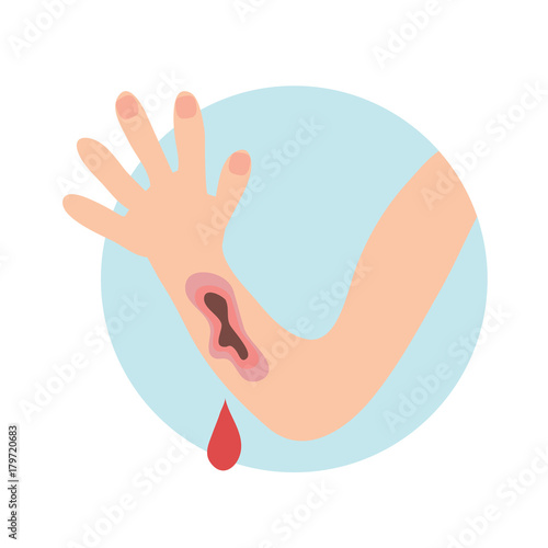 Wounded hand with blood oozing. Blood dripping down. Isolated flat illustration on white backgroud. Cartoon vector image.