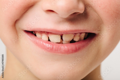 Caucasian European school boy closeup portrait