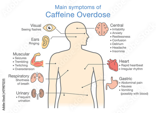 Vászonkép Main symptoms of Caffeine Overdose