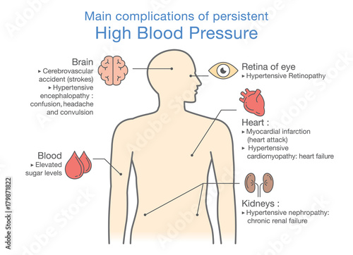 Main complications of persistent High Blood Pressure. Illustration about health and medical.