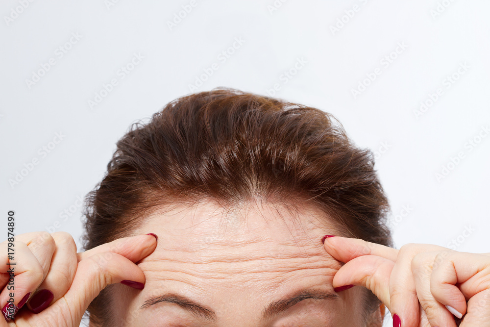 Fototapeta premium Macro Woman face with wrinkles on the forehead. Collagen and face injections concept. Menopause. Cropped image. Copy space and mock up.