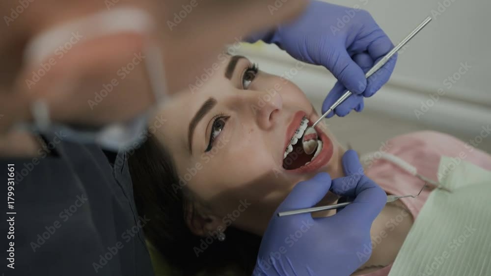 Healthy teeth. Close-up The dentist examines the patient's teeth Healthy teeth. Close-up The dentist examines the patient's teeth