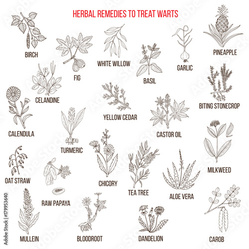 Best herbal remedies to treat warts