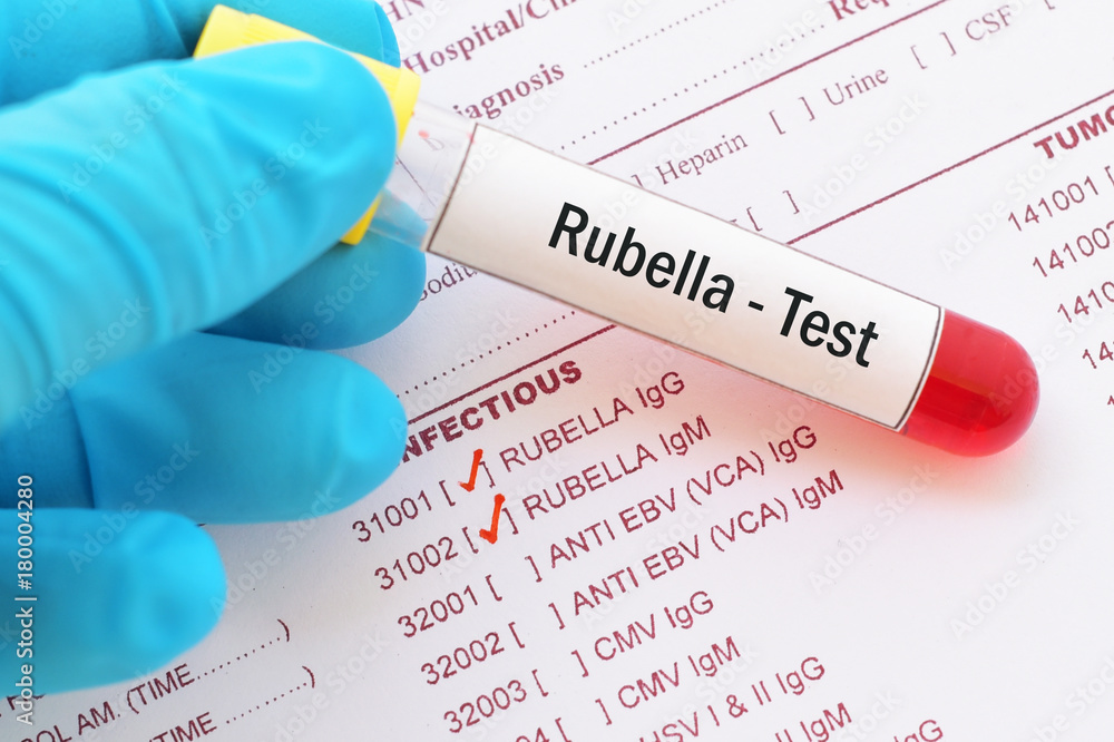 Blood sample with requisition form for rubella virus test Stock Photo