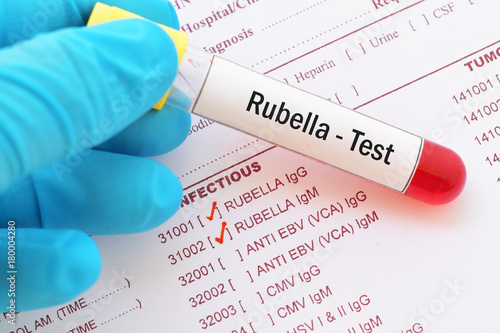 Blood sample with requisition form for rubella virus test
 photo