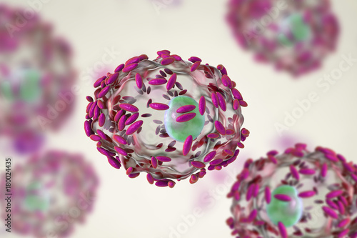 Slika na platnu Microscopic diagnosis of bacterial vaginosis