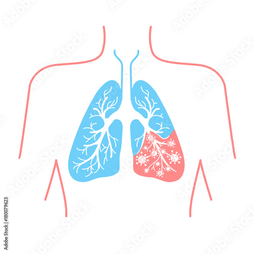 icon of lung disease pneumonia photo