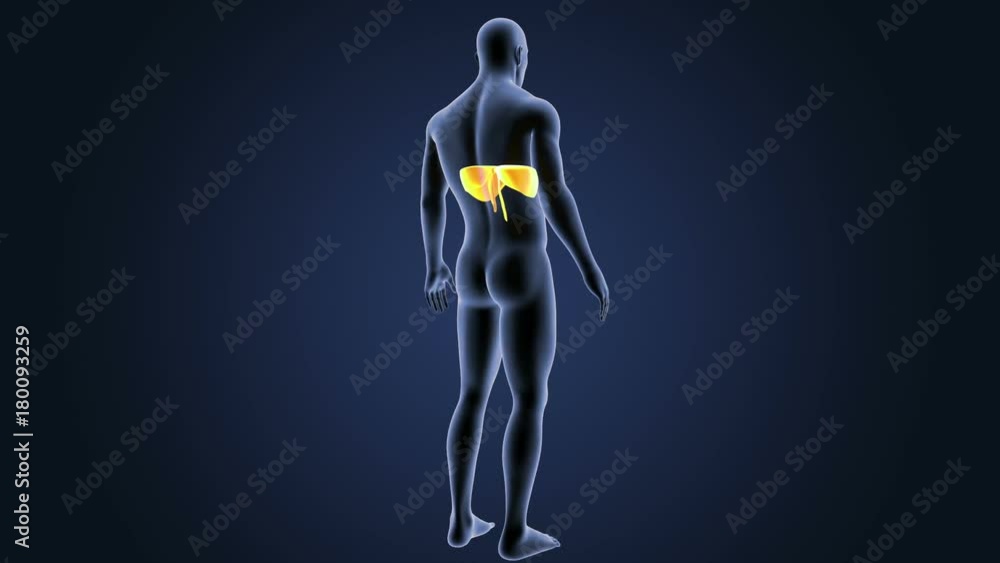 Diaphragm with Body Diaphragm with Body
