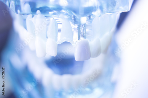 Dentsts dental teeth model