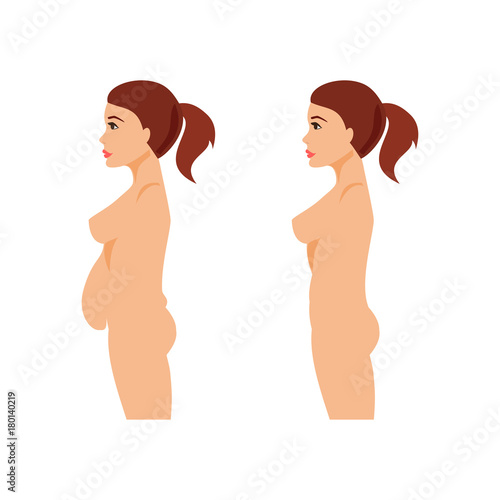 Abdominal surgery
