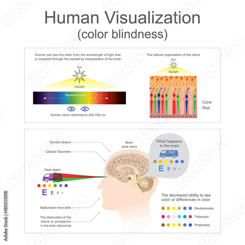 Human can see the color from wavelength of light. The destruction of the retina or perception in the brain abnormal. Illustration human body.