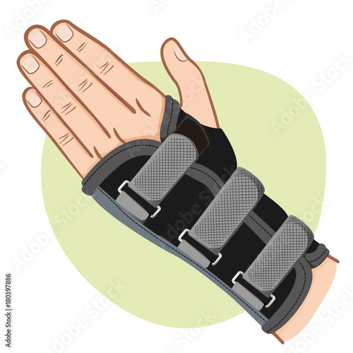 Illustration depicts a hand with wrist, tendinitis, Caucasian. Ideal for training and institutional materials