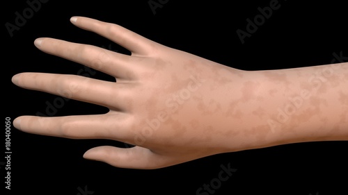 Hand skin age spots medium surface color. 3d rendering