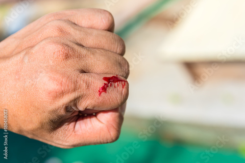 Real blood  on finger after knife accident