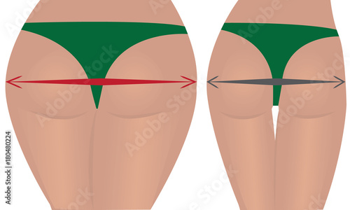 Fat and slim  girls' back. 