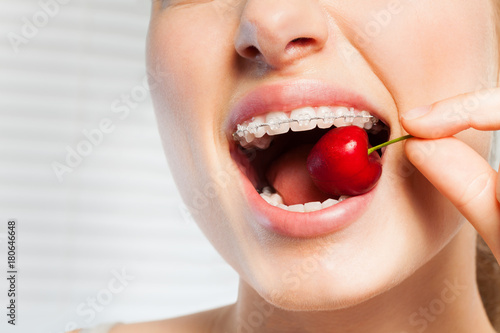 Woman with dental brackets biting off red cherry