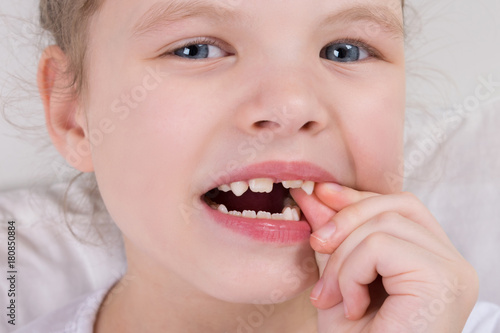 a little girl wobbles a milk tooth, with two fingers