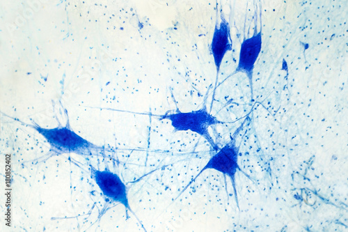 Light micrograph of human brain tissue showing neurons and glial cells