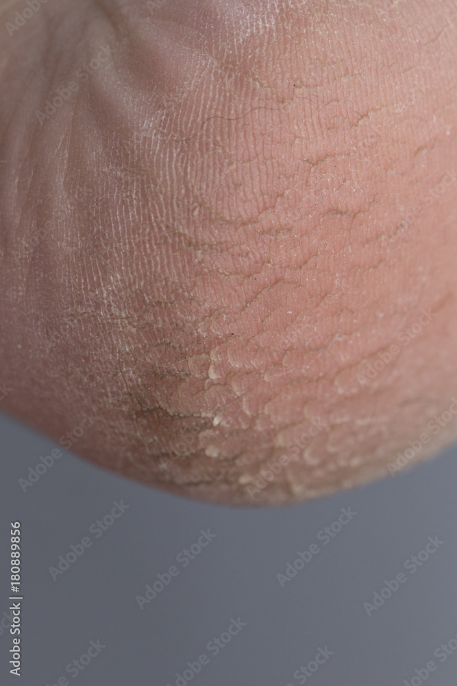 Fototapeta premium human heel break
