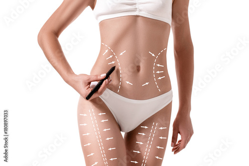 Female body with the drawing arrows on it isolated on white. Fat lose, liposuction and cellulite removal concept.