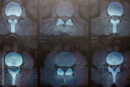 Fotografía Magnetic resonance imaging.