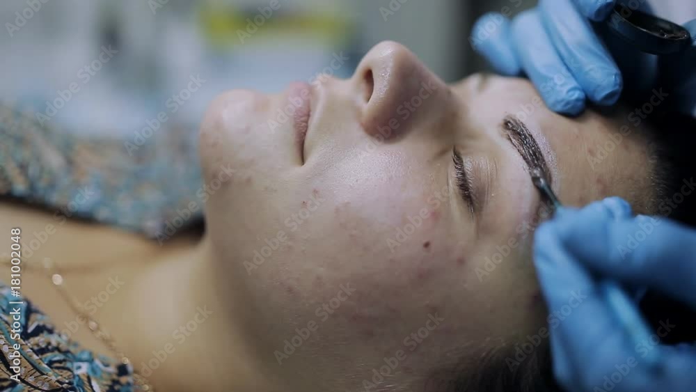 Professional Cosmetologist makes eyebrow correction in a girl with problem skin on her face Professional Cosmetologist makes eyebrow correction in a girl with problem skin on her face