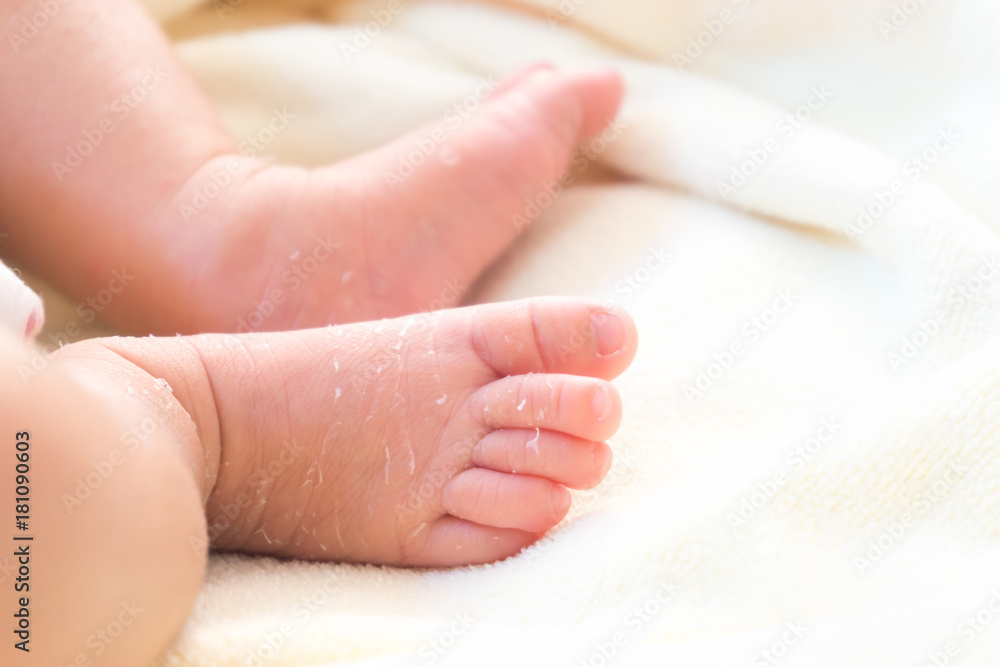 Closeup legs of newborn with peeling skin on white cloth, health care and medical concept, selective focus Closeup legs of newborn with peeling skin on white cloth, health care and medical concept, selective focus