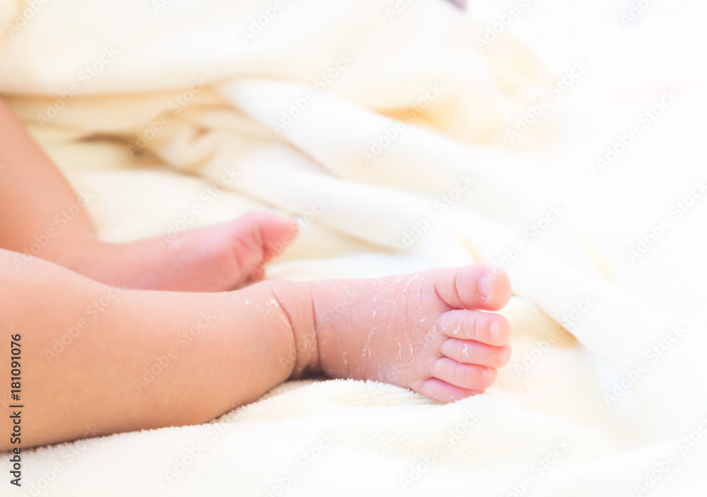 Closeup legs of newborn with peeling skin on white cloth, health care and medical concept, selective focus Closeup legs of newborn with peeling skin on white cloth, health care and medical concept, selective focus