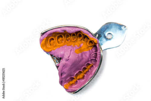 Dentist dental teeth impression mold with compound